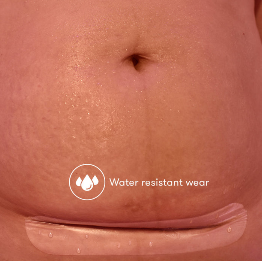 C-Section Silicone Scar Patches